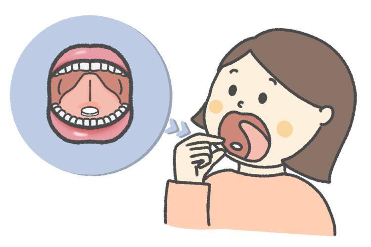 舌下免疫療法のイメージイラスト